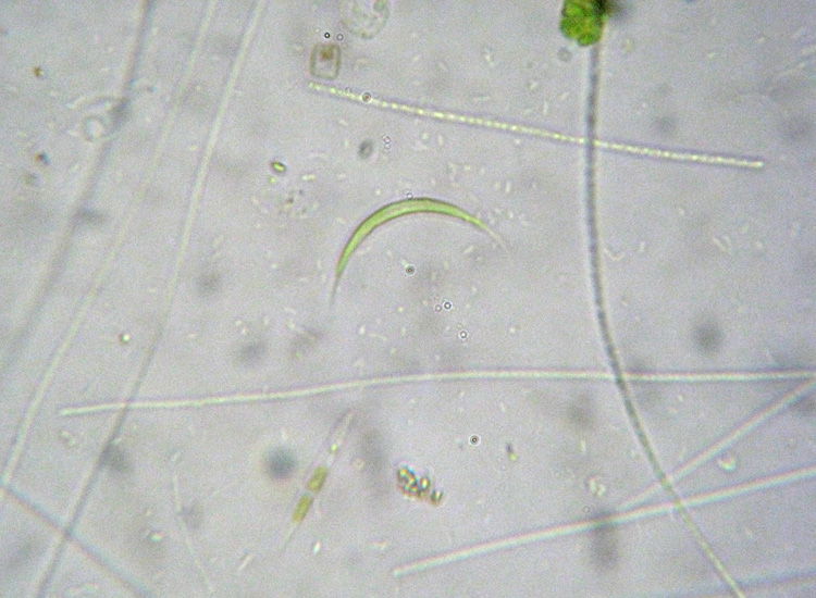 Canale Bruciati, SIC Valli di Novellara RE: le alghe